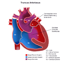 Haga clic en la imagen para ampliarla Anatomía de un corazón con conducto con tronco arterial